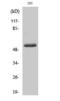 Matrix Metallopeptidase 14 antibody, GTX86916, GeneTex, Western Blot image 