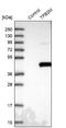 Transcription Factor B2, Mitochondrial antibody, NBP1-82114, Novus Biologicals, Western Blot image 