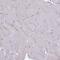 Centromere Protein M antibody, PA5-59969, Invitrogen Antibodies, Immunohistochemistry frozen image 