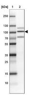 Trimethylguanosine Synthase 1 antibody, NBP1-92271, Novus Biologicals, Western Blot image 