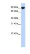 Transmembrane And Tetratricopeptide Repeat Containing 4 antibody, NBP1-59929, Novus Biologicals, Western Blot image 