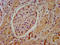 Huntingtin Interacting Protein 1 Related antibody, LS-C673349, Lifespan Biosciences, Immunohistochemistry paraffin image 