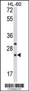 Regulator Of G Protein Signaling 1 antibody, 63-630, ProSci, Western Blot image 