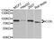 Coilin antibody, STJ28511, St John