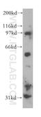Carbohydrate Sulfotransferase 9 antibody, 13135-1-AP, Proteintech Group, Western Blot image 