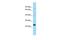 Mediator Complex Subunit 20 antibody, PA5-45788, Invitrogen Antibodies, Western Blot image 