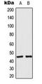 Acyl-CoA Thioesterase 4 antibody, LS-C354216, Lifespan Biosciences, Western Blot image 