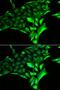 Glycogen Phosphorylase B antibody, LS-C334692, Lifespan Biosciences, Immunofluorescence image 