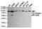 Phosphoinositide-3-Kinase Regulatory Subunit 2 antibody, GTX16481, GeneTex, Western Blot image 