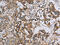 Hydroxysteroid 17-Beta Dehydrogenase 14 antibody, CSB-PA077030, Cusabio, Immunohistochemistry paraffin image 