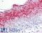 Involucrin antibody, LS-B7607, Lifespan Biosciences, Immunohistochemistry frozen image 