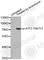 Activating Transcription Factor 2 antibody, AP0128, ABclonal Technology, Western Blot image 