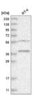 Rhomboid Like 1 antibody, NBP2-57513, Novus Biologicals, Western Blot image 