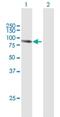 Protein-glutamine gamma-glutamyltransferase K antibody, H00007051-B01P, Novus Biologicals, Western Blot image 