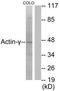 Actin Gamma 2, Smooth Muscle antibody, TA313418, Origene, Western Blot image 