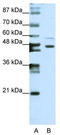 Zinc Finger Protein 558 antibody, TA345510, Origene, Western Blot image 