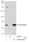 Chaperonin Containing TCP1 Subunit 5 antibody, MA5-27824, Invitrogen Antibodies, Immunoprecipitation image 