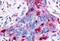 Macrophage Stimulating 1 Receptor antibody, MBS243278, MyBioSource, Immunohistochemistry paraffin image 