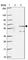 Zinc Finger Protein 34 antibody, HPA060755, Atlas Antibodies, Western Blot image 