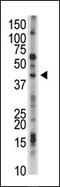 Ubiquitin Specific Peptidase 12 antibody, AP12025PU-N, Origene, Western Blot image 