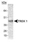 Potassium Two Pore Domain Channel Subfamily K Member 2 antibody, NB110-41535, Novus Biologicals, Western Blot image 