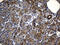 NFKB Inhibitor Epsilon antibody, LS-C795595, Lifespan Biosciences, Immunohistochemistry paraffin image 