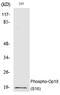 Stathmin 1 antibody, PA5-40206, Invitrogen Antibodies, Western Blot image 