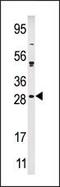 Calcium And Integrin Binding Family Member 2 antibody, PA5-15481, Invitrogen Antibodies, Western Blot image 