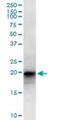 Leucine Zipper And CTNNBIP1 Domain Containing antibody, H00084328-B01P, Novus Biologicals, Western Blot image 