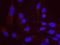 RAD18 E3 Ubiquitin Protein Ligase antibody, NB100-61063, Novus Biologicals, Proximity Ligation Assay image 