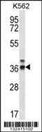 Ribonuclease P/MRP Subunit P38 antibody, 56-619, ProSci, Western Blot image 