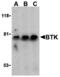 Tyrosine-protein kinase BTK antibody, MBS150593, MyBioSource, Western Blot image 