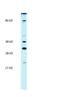 Poly(ADP-Ribose) Polymerase Family Member 11 antibody, A11416, Boster Biological Technology, Western Blot image 