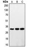 Ring Finger Protein 144A antibody, LS-C353197, Lifespan Biosciences, Western Blot image 