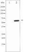 Interleukin 10 Receptor Subunit Alpha antibody, TA325563, Origene, Western Blot image 