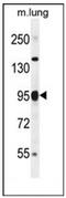 Poly(ADP-Ribose) Polymerase Family Member 9 antibody, AP53168PU-N, Origene, Western Blot image 