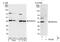 UV excision repair protein RAD23 homolog A antibody, NBP1-49977, Novus Biologicals, Western Blot image 