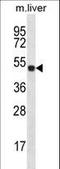 Homeobox D10 antibody, LS-C164989, Lifespan Biosciences, Western Blot image 