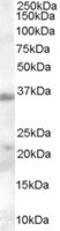 Hepatitis A Virus Cellular Receptor 2 antibody, MBS421344, MyBioSource, Western Blot image 