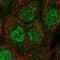 Ubiquitin Conjugating Enzyme E2 A antibody, NBP2-57290, Novus Biologicals, Immunocytochemistry image 