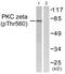 Protein Kinase C Zeta antibody, PA5-38419, Invitrogen Antibodies, Western Blot image 