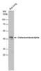 Galactosidase Alpha antibody, PA5-27349, Invitrogen Antibodies, Western Blot image 