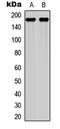 Laminin Subunit Gamma 1 antibody, MBS8231905, MyBioSource, Western Blot image 