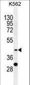 Serpin Family B Member 4 antibody, LS-C161433, Lifespan Biosciences, Western Blot image 