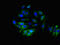 Aldehyde Dehydrogenase 3 Family Member B1 antibody, LS-C673200, Lifespan Biosciences, Immunofluorescence image 