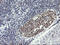 Replication Factor C Subunit 4 antibody, M07702, Boster Biological Technology, Immunohistochemistry paraffin image 
