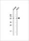 SRC Proto-Oncogene, Non-Receptor Tyrosine Kinase antibody, M00107-3, Boster Biological Technology, Western Blot image 