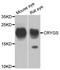 Crystallin Gamma S antibody, orb373833, Biorbyt, Western Blot image 
