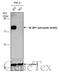 Eukaryotic Translation Initiation Factor 4E Binding Protein 1 antibody, GTX133184, GeneTex, Western Blot image 