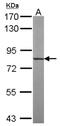 Tubulin Tyrosine Ligase Like 12 antibody, NBP2-15149, Novus Biologicals, Western Blot image 